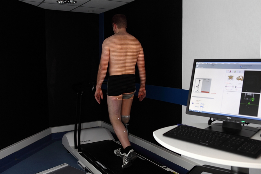 Ein Patient bei der Ganganalyse Ein Patient bei der Ganganalyse
